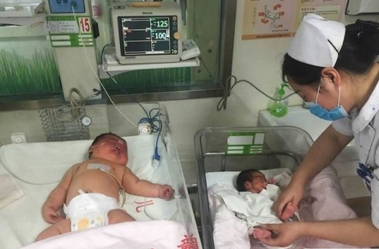 В Китае родился гигантский младенец — вес новорожденного превысил отметку 6,2 кг