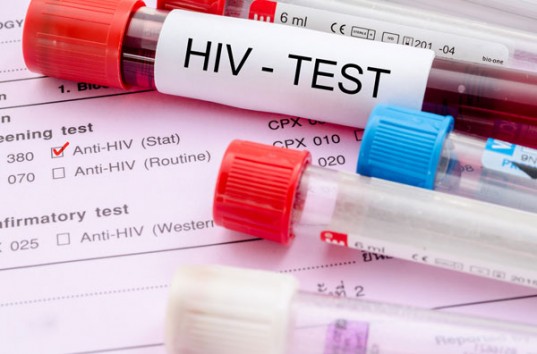 Британским медикам удалось впервые в истории вылечить человека от ВИЧ