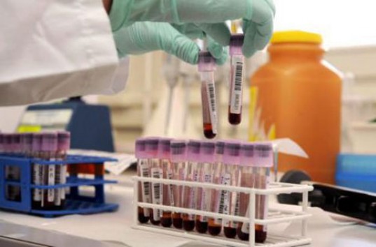 Японские медики обнаружили две новые группы крови