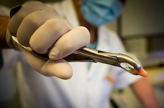 Стоматолог удалил себе зуб и снял все на видео (ВИДЕО 18+)