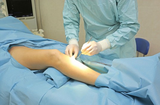 Удаление варикозных вен на ногах: современные методы процедур и их особенности