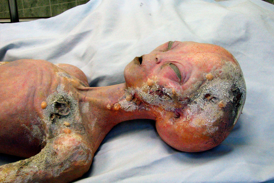 Рассказы о телах пришельцев от Гленна Дэнниса, бальзамировщика тел в Розуэлле