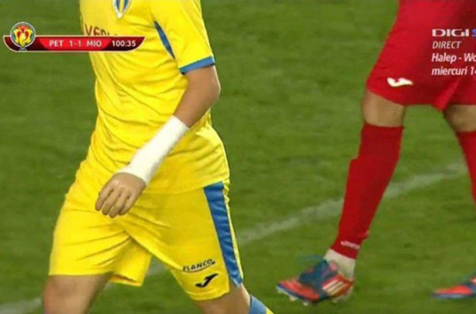 В матче Кубка Румынии дебютировал футболист без руки