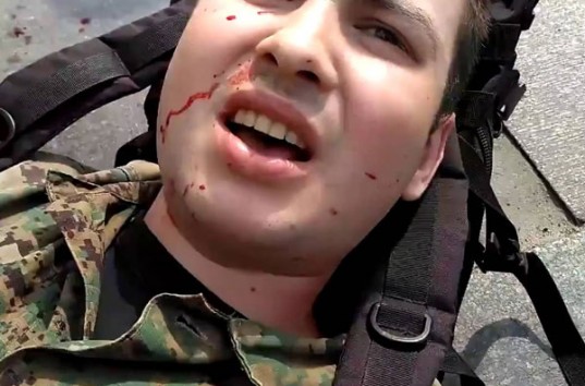 В Киеве подрезали националиста, который напал на женщину с ребенком в День Победы (ВИДЕО)