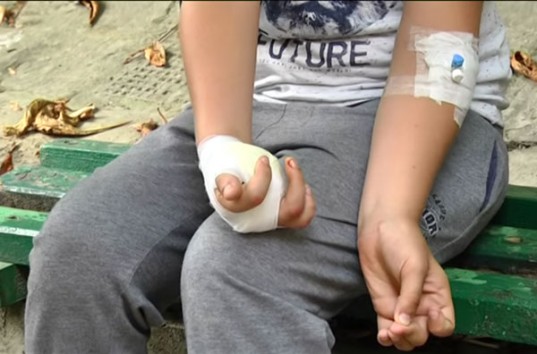 На Львовщине десятикласница оторвала палец пятикласнику (ВИДЕО)