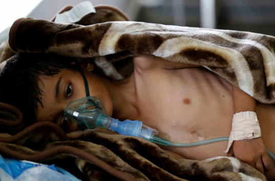 Йемен находится перед угрозой эпидемии холеры: уже 250 жертв