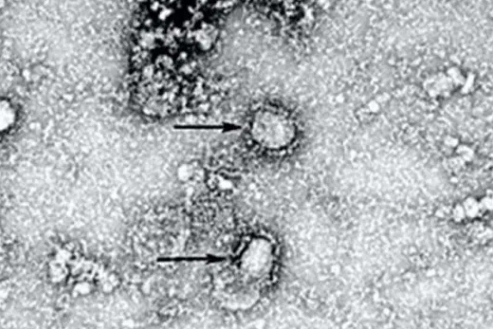 В Китае опубликовали первый снимок коронавируса: удалось выделить штамм вируса
